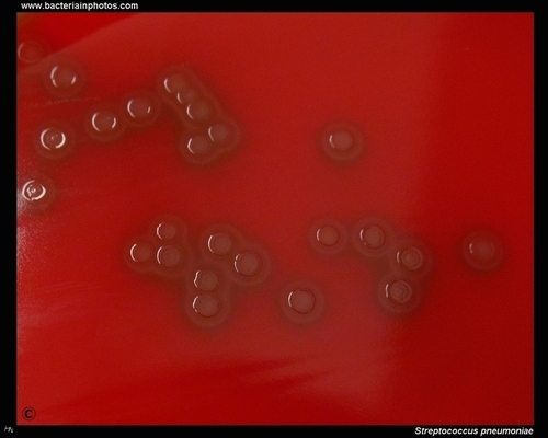 alpha-hemolysis